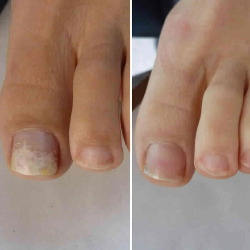 Welnax BioClear user3